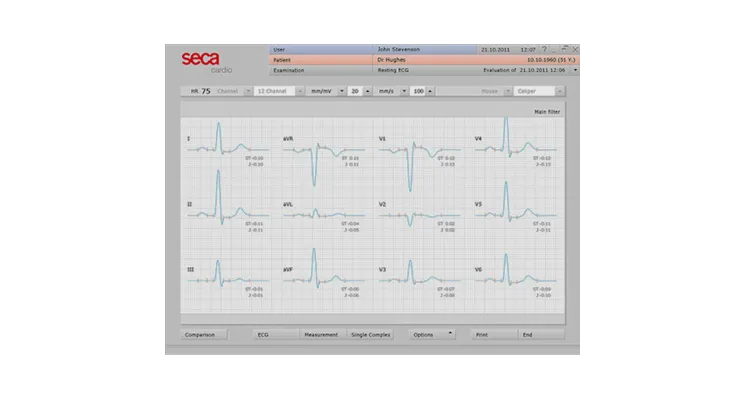 Reconditioned Seca CT320 USB ECG Machine