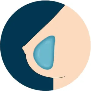 SE  Breast Option - Gel Breasts
